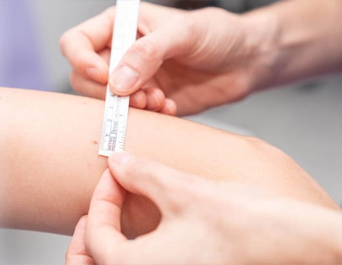 Fractional-Co2-Laser-Skin-Rejuvenation-1-1.jpg