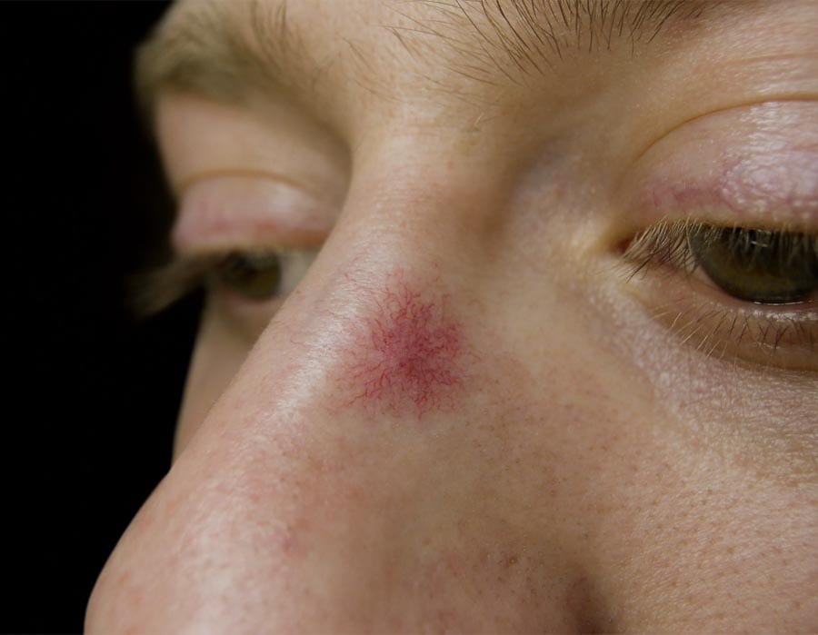 Skin-Cancer-Checks.jpg