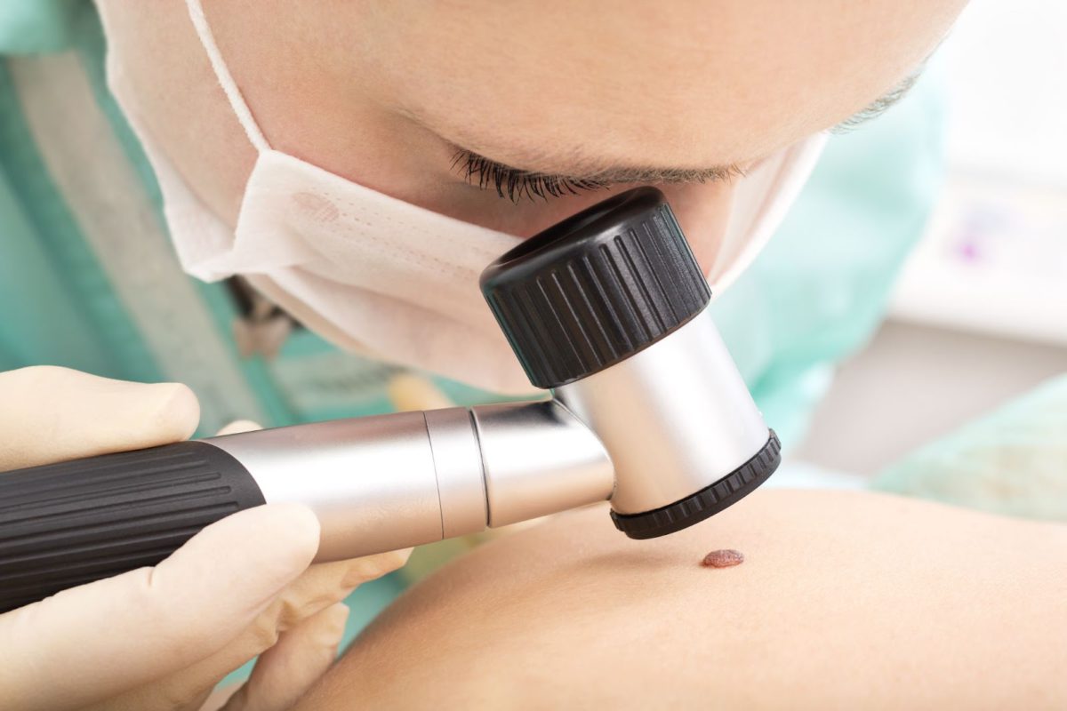 skin-cancer-check-1200x800.jpg